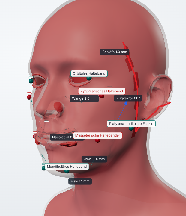 Project 4: Facelift simulation
